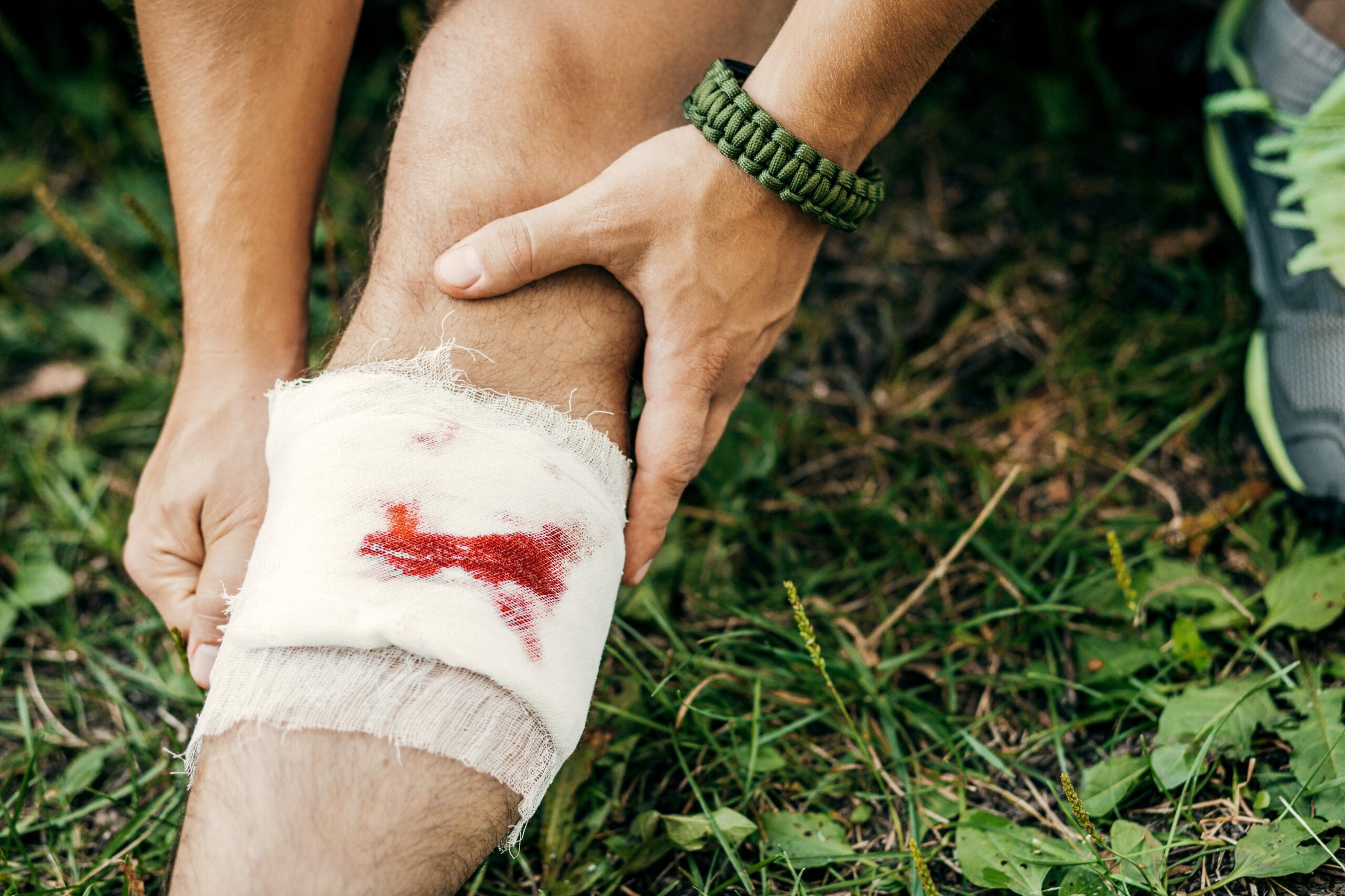 A hiker applies a makeshift bandage to a knee injury while on a wilderness trek, demonstrating the importance of first aid knowledge in survival situations.